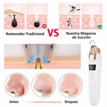 DermaLuxe™  Limpiador de puntos Negros